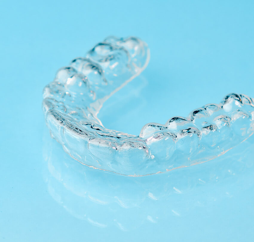 Feel Confident During Every Step With Clear Aligners in Coeur d'Alene